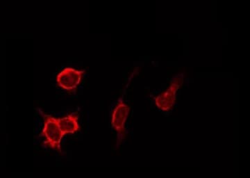CTSD / Cathepsin D Antibody
