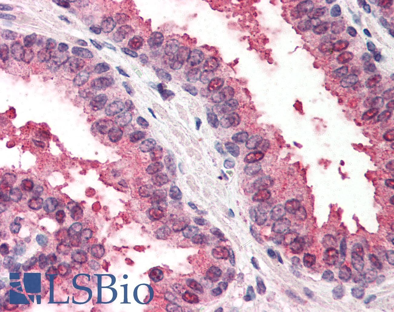 IHC-plus™ Polyclonal Goat anti-Human RAD23B / HR23B Antibody (aa155-180, IHC, WB)