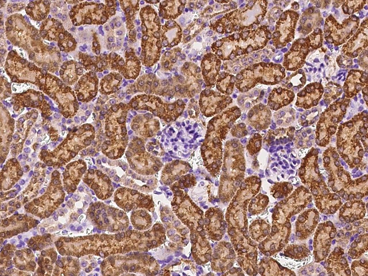 FH / Fumarase / MCL Antibody