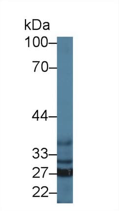 SFXN1 Antibody (aa2-102, Cy3)