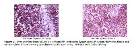 MAP2K4 / MKK4 Antibody (clone 2D10D8, 4G11 B2)