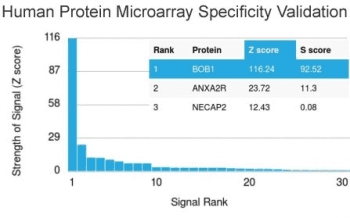 POU2AF1 / BOB1 Antibody (clone BOB1/2421)
