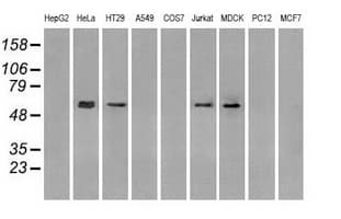 Monoclonal Mouse anti-Human GBP2 Antibody (clone OTI1E5, IHC, IF, WB)