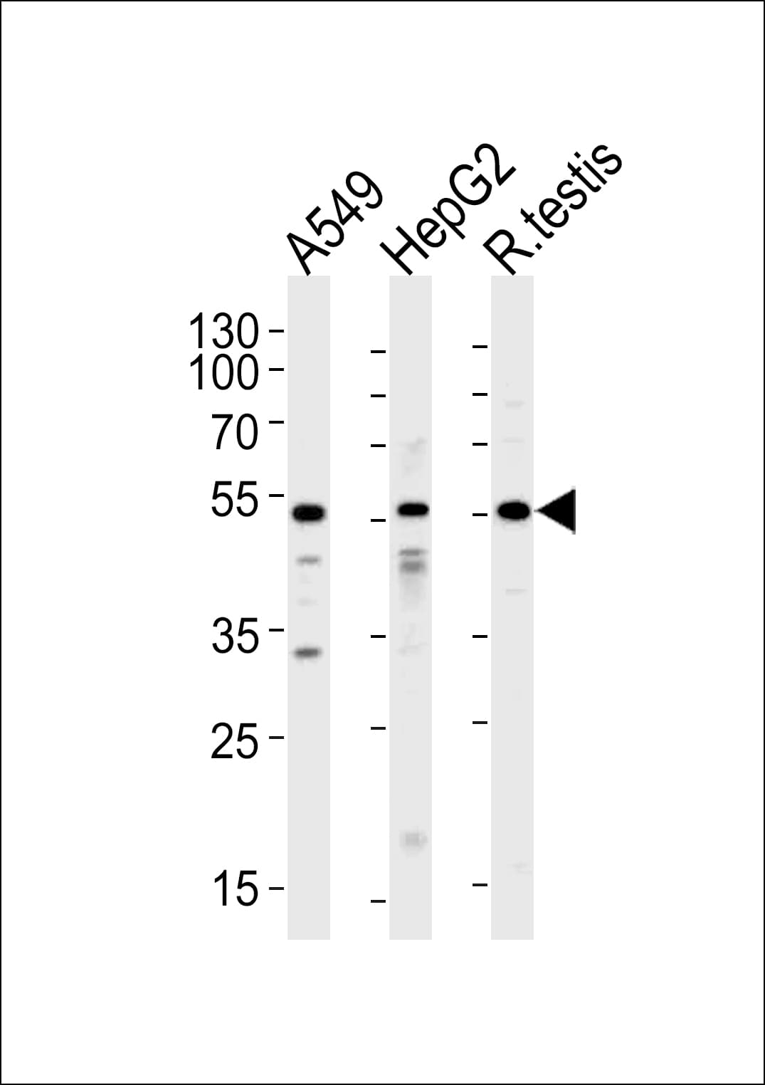 Polyclonal Rabbit anti-Human ALK2 / ACVR1 Antibody (aa6-34, IHC, WB)