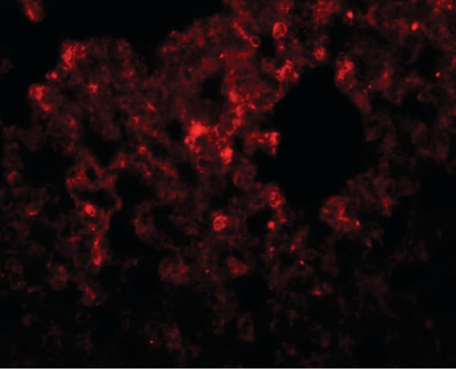 IHC-plus™ RHBDD3 Antibody