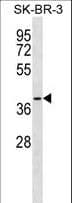 SFXN3 / Sideroflexin 3 Antibody (aa288-314)
