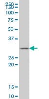 GSTZ1 Antibody (clone 1G12)