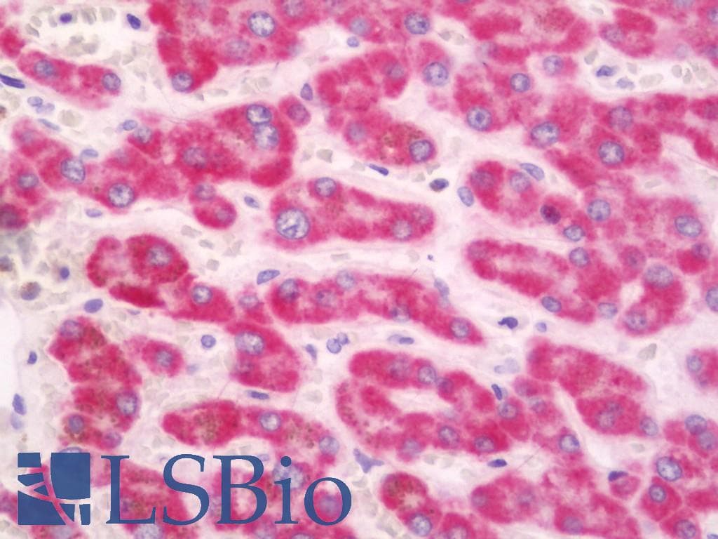 IHC-plus™ CHRNA1 Antibody (aa168-217)