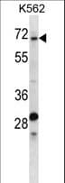 Polyclonal Rabbit anti-Human TRIP10 / CIP4 Antibody (aa115-144, WB)