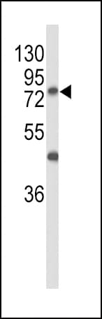 GALNT3 Antibody (aa454-481)
