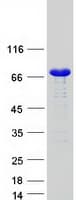 Human SNX1 Protein (Recombinant Myc-DDK (Flag))