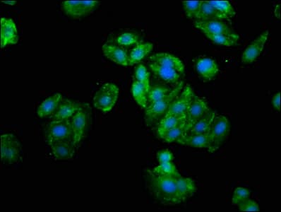 Polyclonal Rabbit anti-Human GLI / GLI1 Antibody (WB)