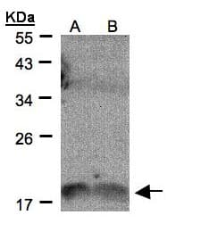 IL1F9 Antibody (aa105-169)