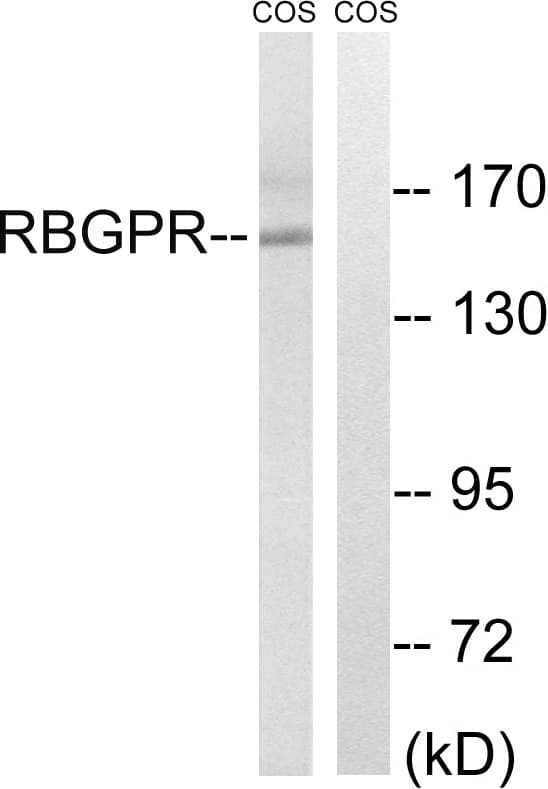 RAB3GAP2 / p150 Antibody (aa417-466)