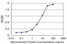 KLF5 / BTEB2 Antibody (clone 2G12)
