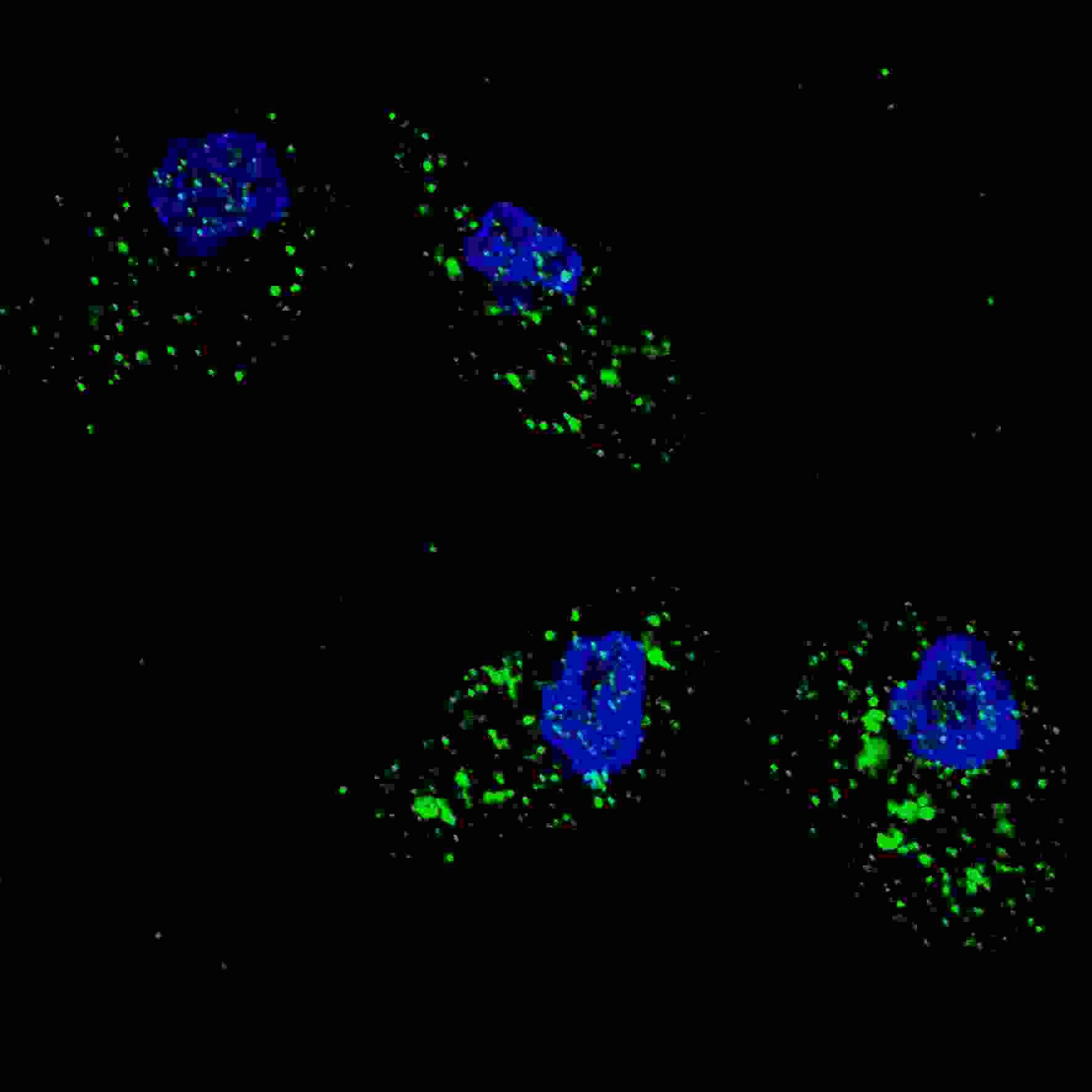Polyclonal Rabbit anti-Human SQSTM1 Antibody (aa317-346, IHC, IF, WB)