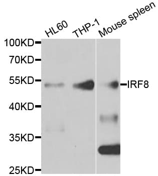 ICSBP / IRF8 Antibody