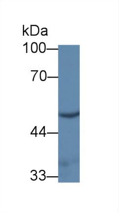 UMPS / OPRT Antibody (aa311-481)