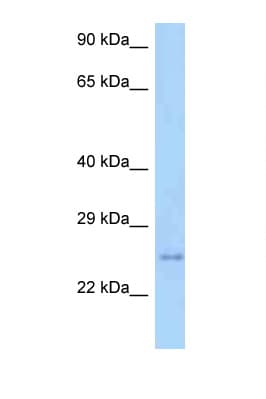 TM2D3 Antibody (C-Terminus)