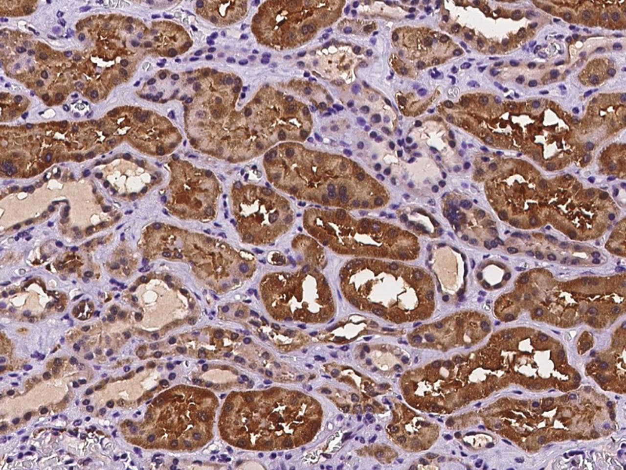 DUS1L Antibody