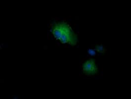 CTAG1B / NY-ESO-1 Antibody (clone OTI3H8, Carrier-free)