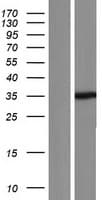 SETD3 Protein (Over-Expression Lysate Myc-DDK (Flag))