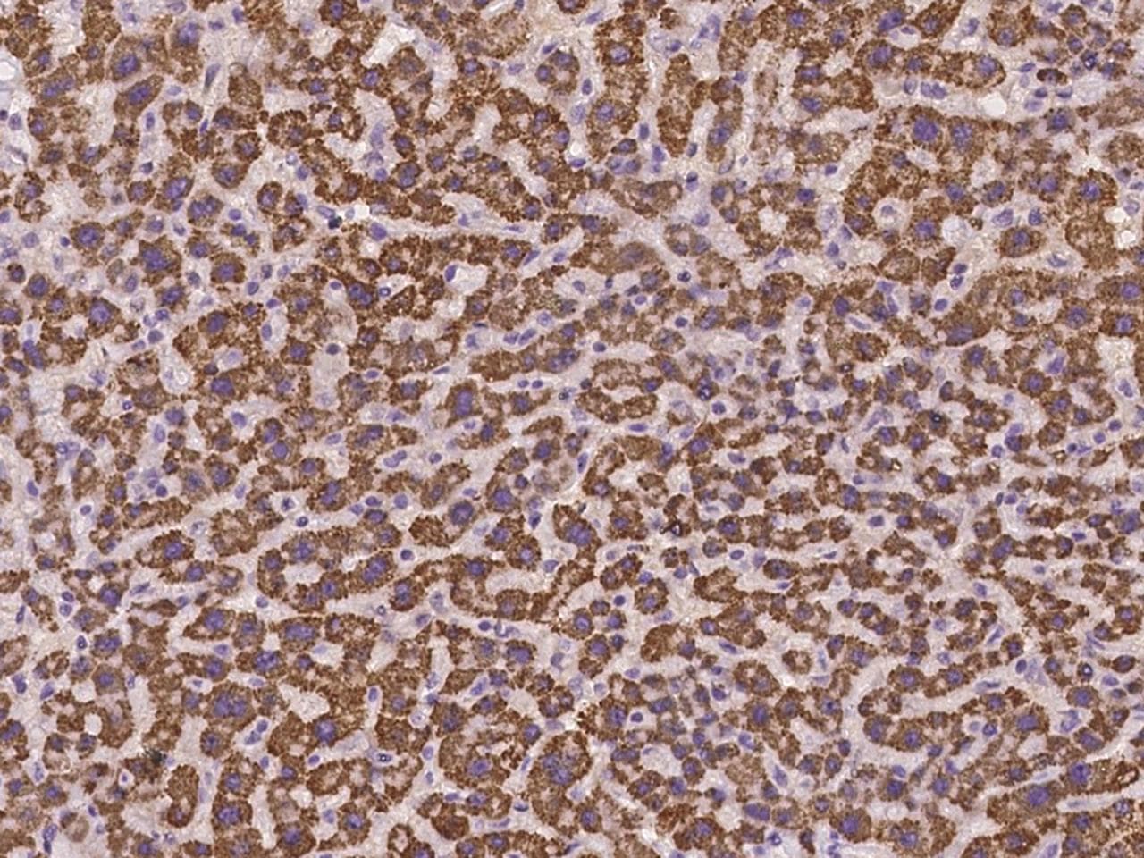 FZD6 / Frizzled 6 Antibody