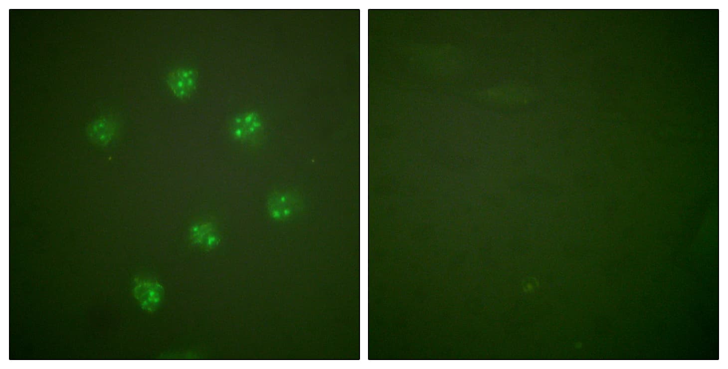 Polyclonal Rabbit anti-Human MKI67 / Ki67 Antibody (aa3207-3256, IHC, IF)