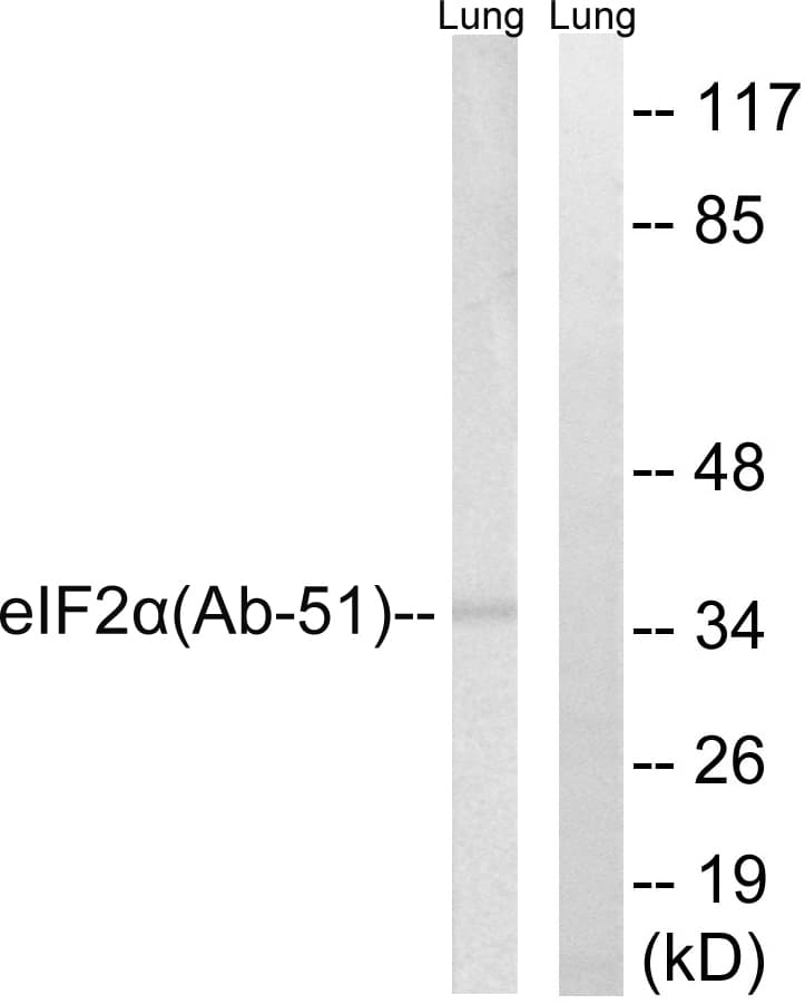 IHC-plus™ EIF2S1 Antibody (aa21-70)