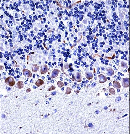 EPHA4 / EPH Receptor A4 Antibody (aa464-492)