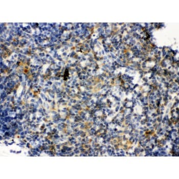 TLR7 / CD287 Antibody (aa1020-1047)