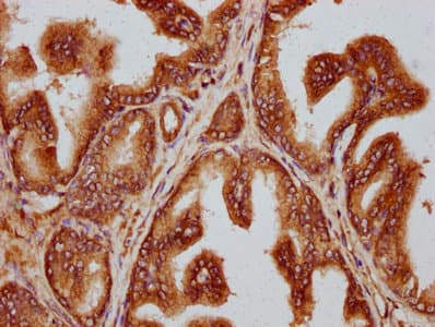 TTLL3 Antibody