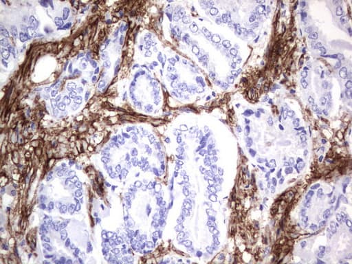 MCAM / CD146 Antibody (clone UMAB154)