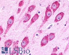 PathPlus™ ADGRL3 / LPHN3 Antibody (C-Terminus)