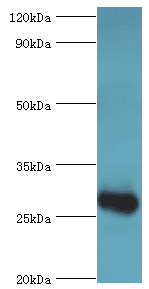 C4BPB / C4BP Beta Antibody (aa18-252)