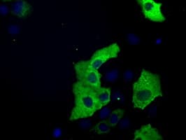 ERIC-1 / TACC3 Antibody (clone OTI6C6)