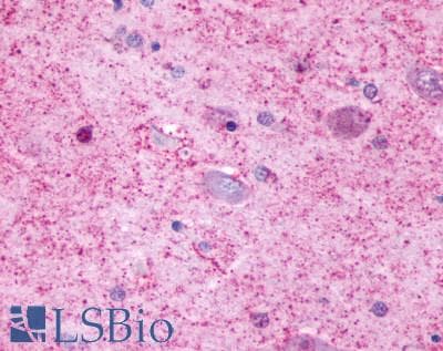 PathPlus™ HTR4 / 5-HT4 Receptor Antibody (Cytoplasmic Domain)