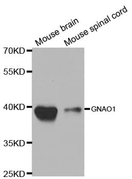 IHC-plus™ GNAO1 Antibody