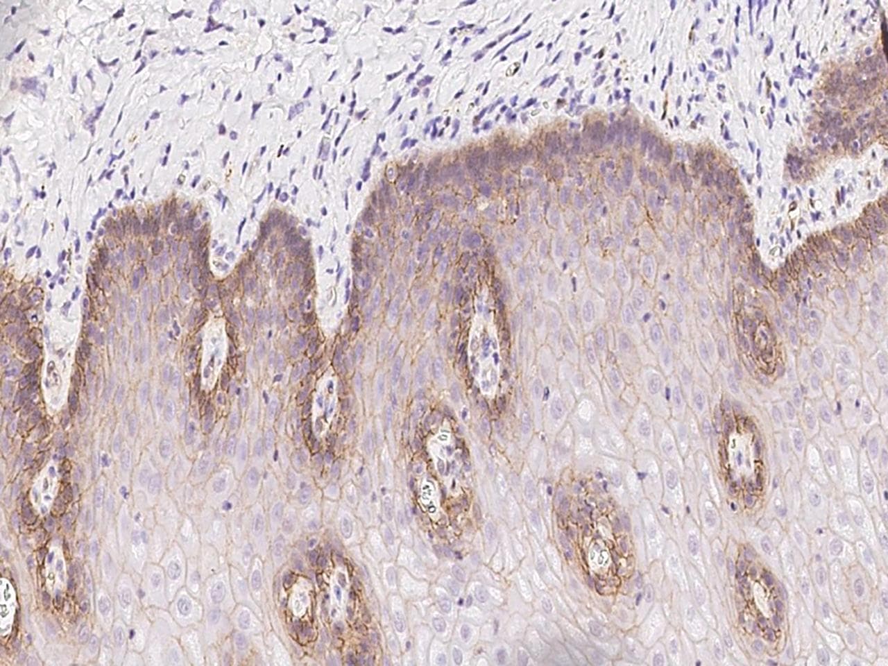 Polyclonal Rabbit anti-Human CDCP1 Antibody (IHC, WB)