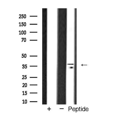 TBP / GTF2D Antibody