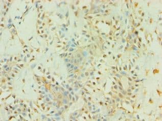 Polyclonal Rabbit anti-Human BAG5 Antibody (aa198-447, IHC, WB)