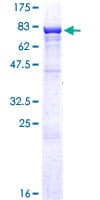 Human ZKSCAN3 / ZNF306 Protein (Recombinant GST)
