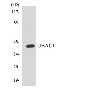 UBAC1 / KPC2 Antibody (aa77-126)