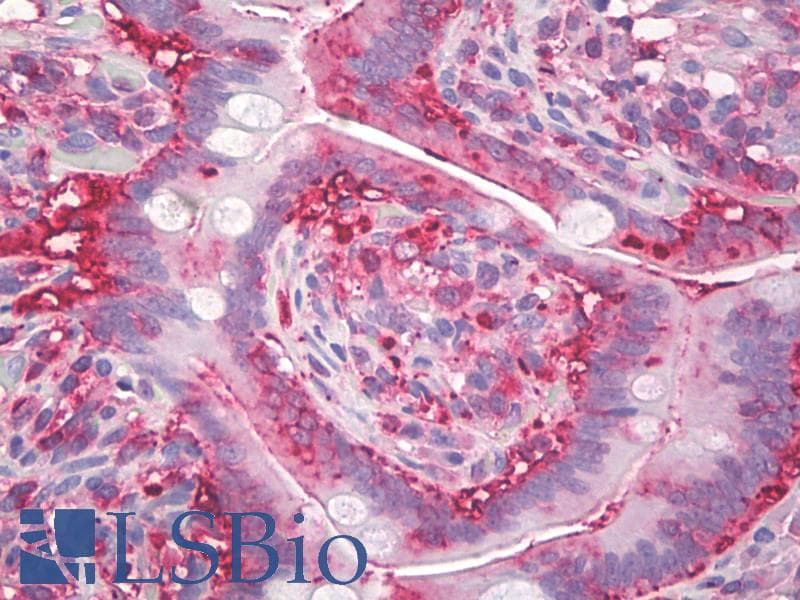 IHC-plus™ AGR2 Antibody (aa50-100, clone IMG10E2)