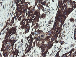 TPD52L3 Antibody (clone OTI8C12)