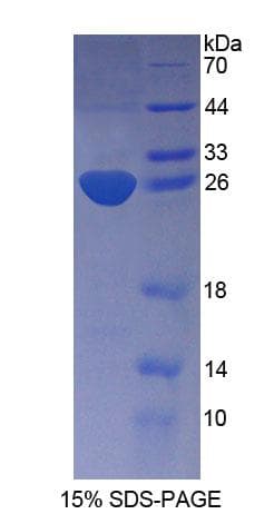 Mouse KATNA1 Protein (Recombinant His-T7)