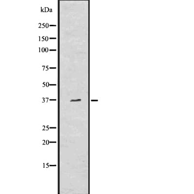 AQP7 / Aquaporin 7 Antibody