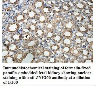 Polyclonal Rabbit anti-Human ZNF266 Antibody (aa22-254, IHC, WB)