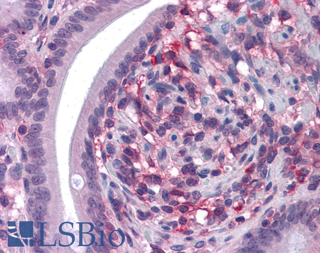 IHC-plus™ Monoclonal Mouse anti-Human CD69 Antibody (clone 8B6, IHC, WB)
