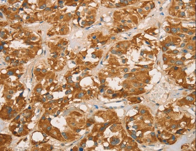 Polyclonal Rabbit anti-Human RBBP8 / CTIP Antibody (IHC)